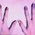 Isquemia distal