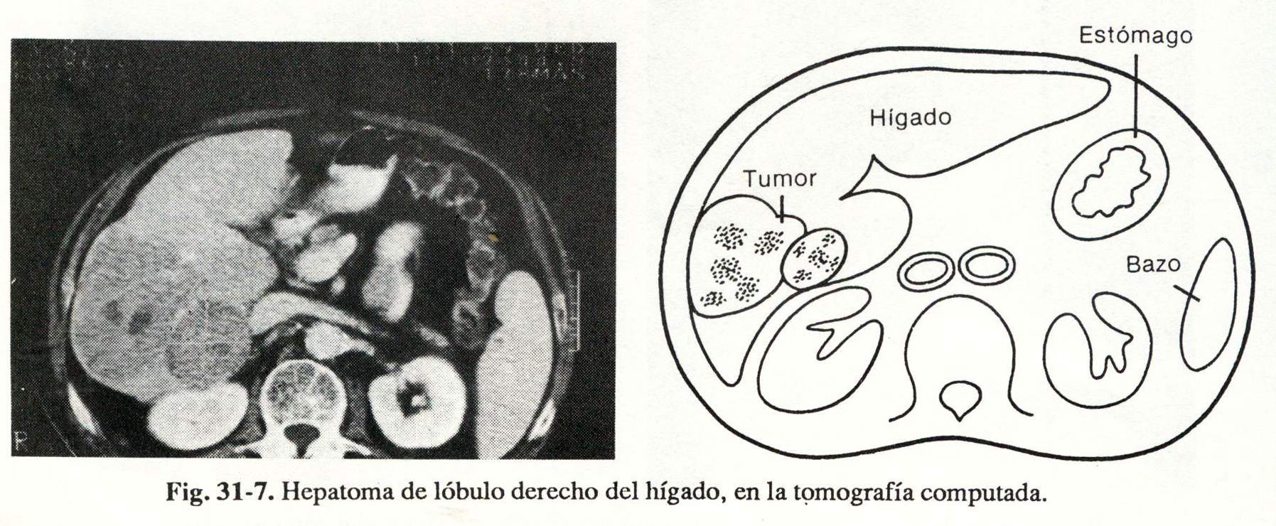 abdomen04