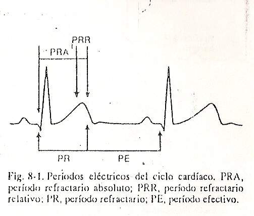 arritmia02