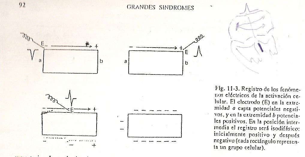 ecg03