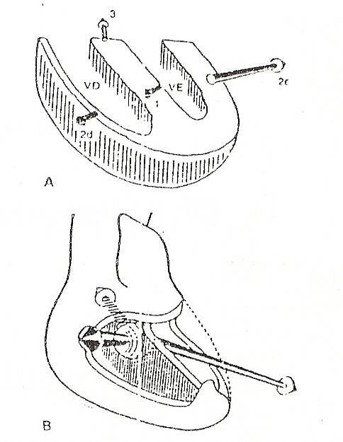 ecg04