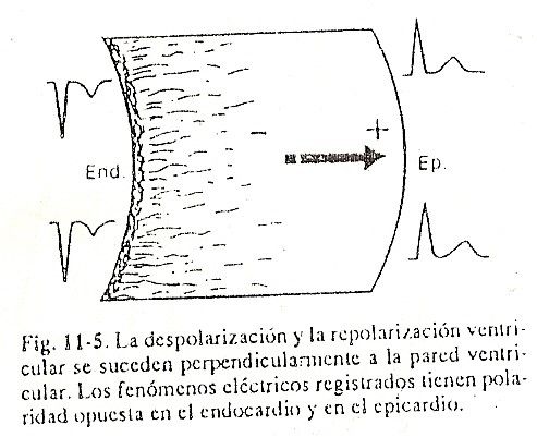 ecg05