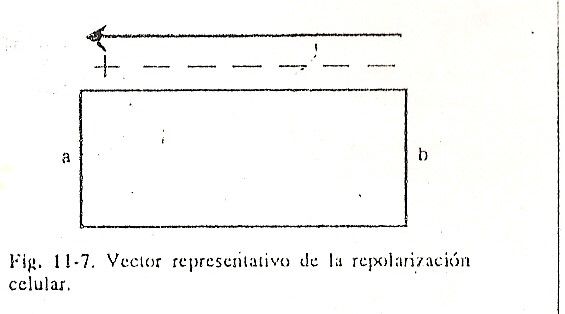 ecg07