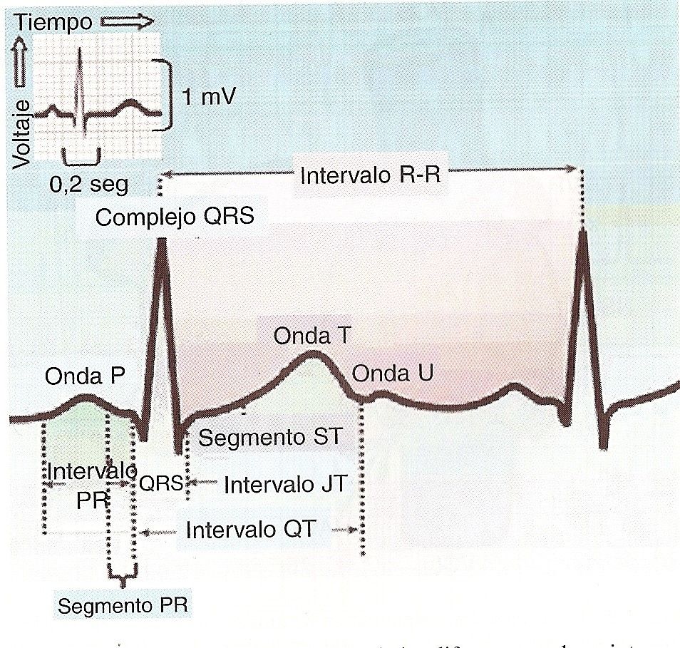 ecg13