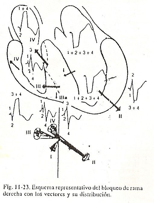 ecg22