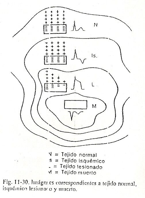 ecg29