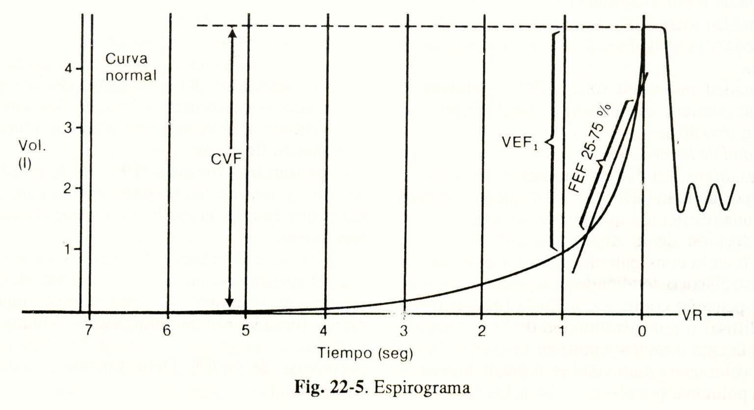 espiro06