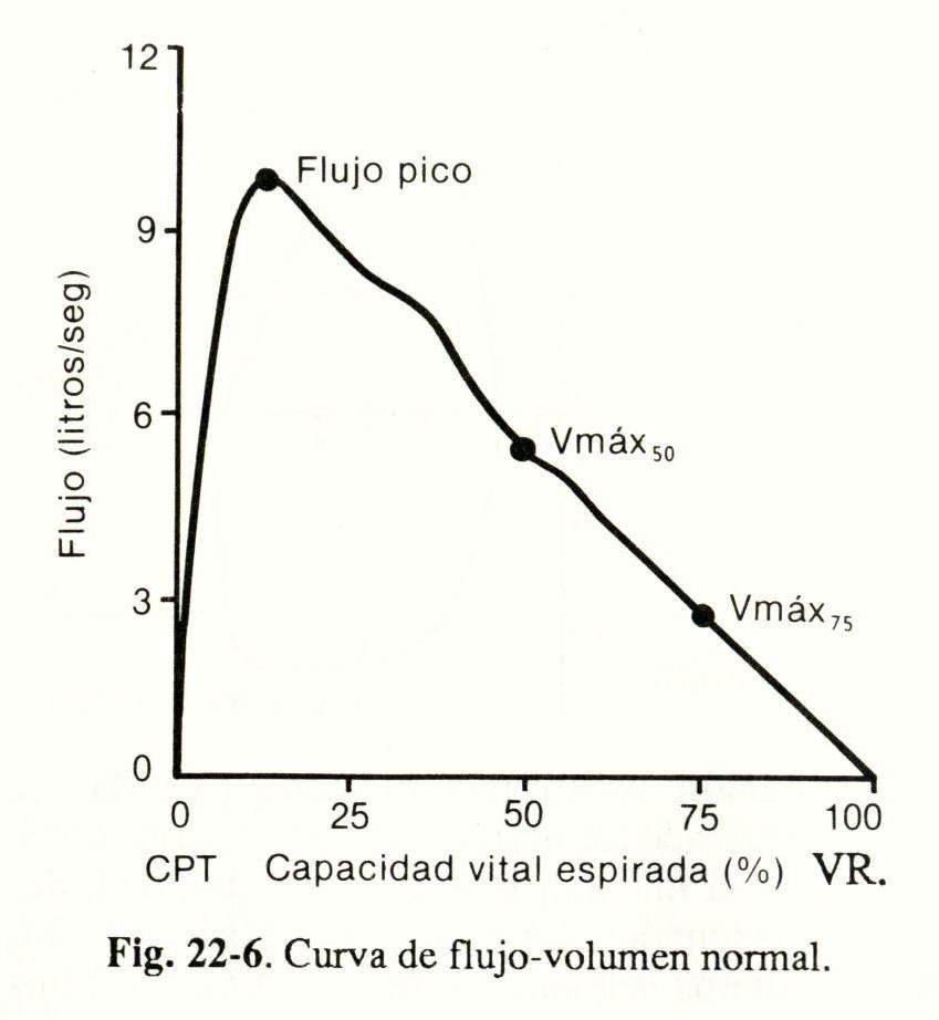 espiro07