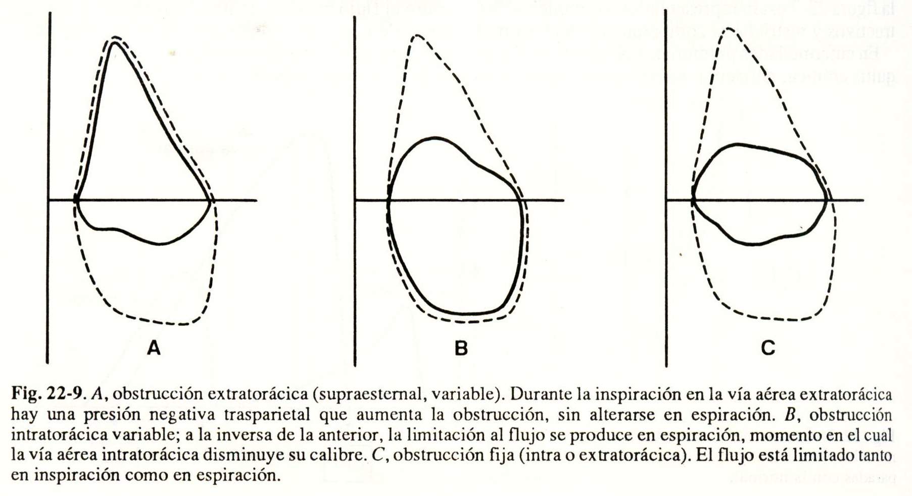 espiro10