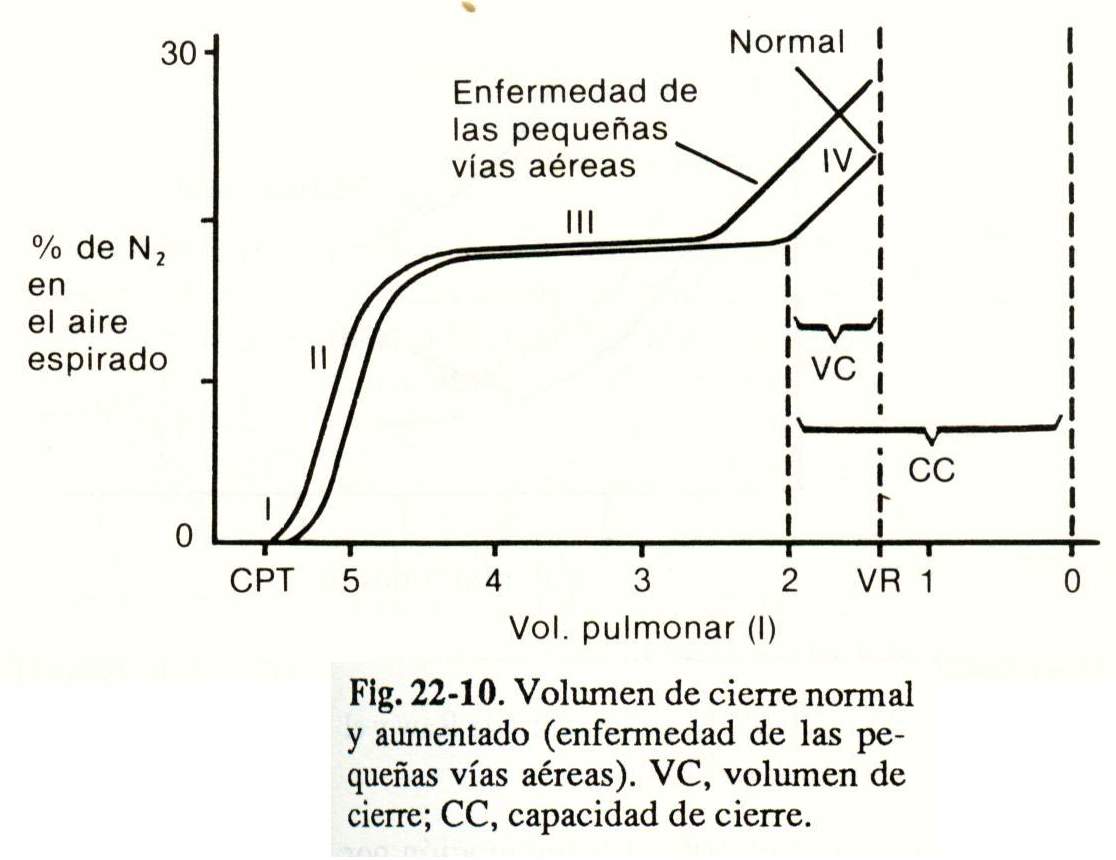 spiro11