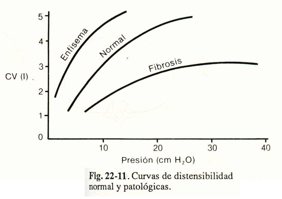 spiro12