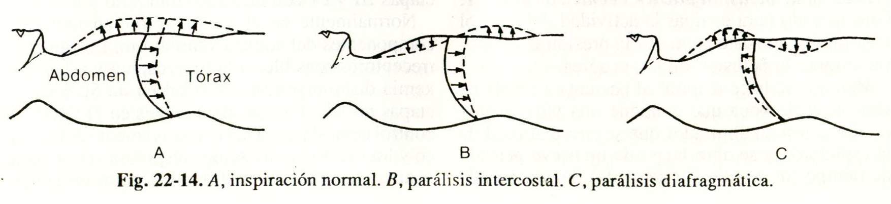 spiro14