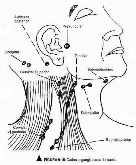 excabeza10