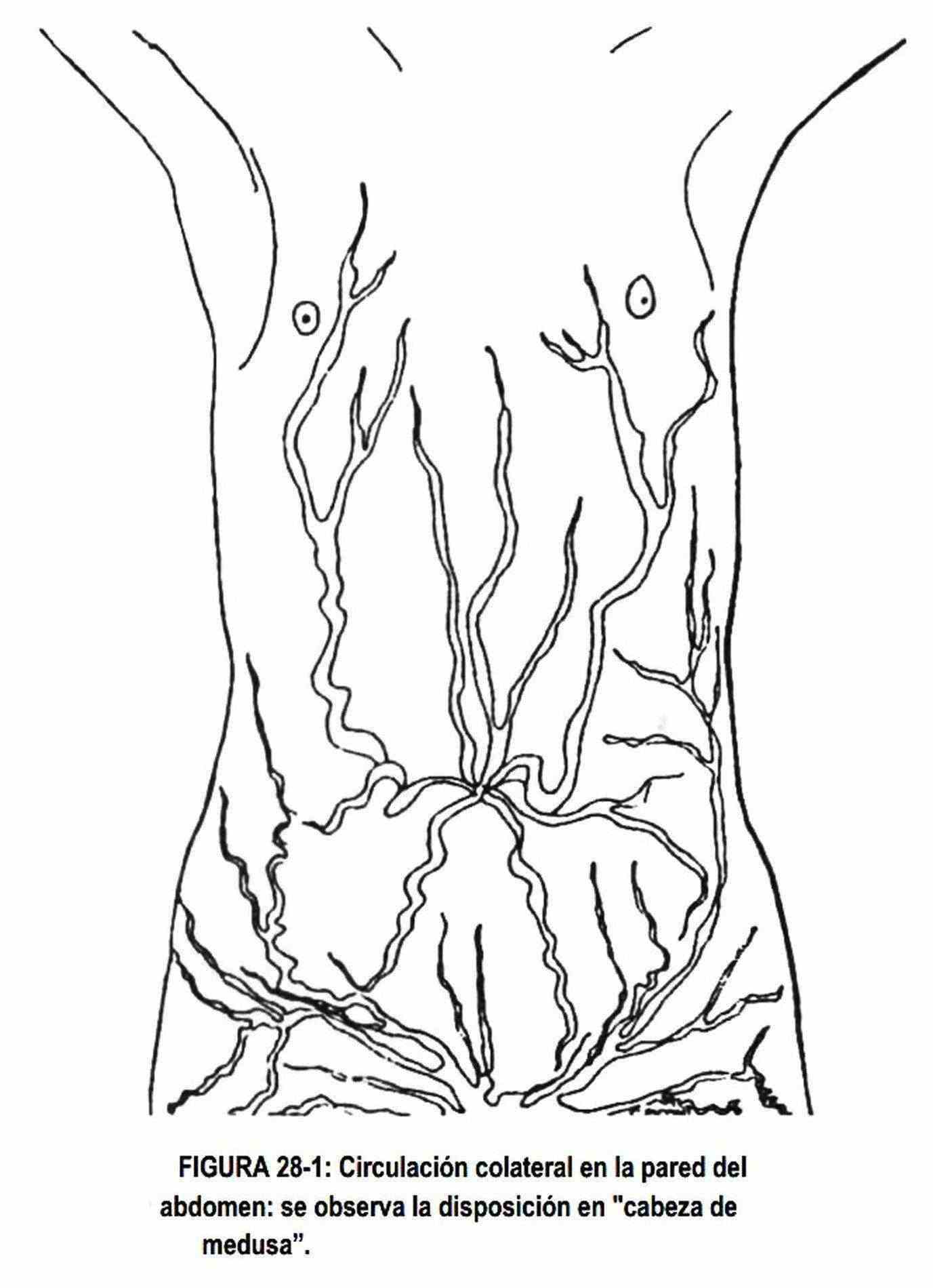 Exploración física del abdomen