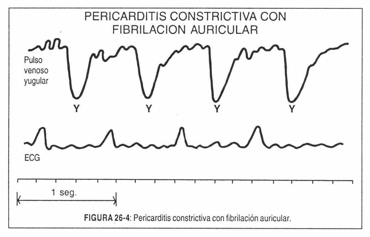 hacardio04