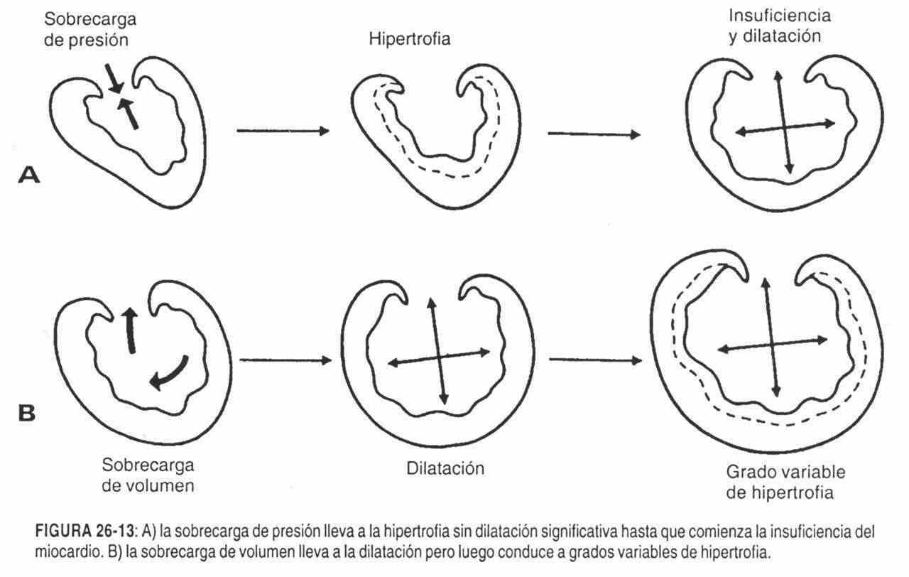 hacardio14