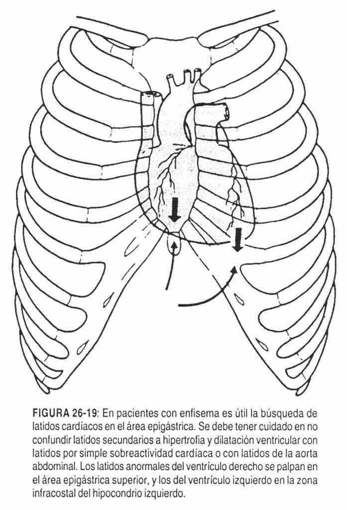 hacardio20