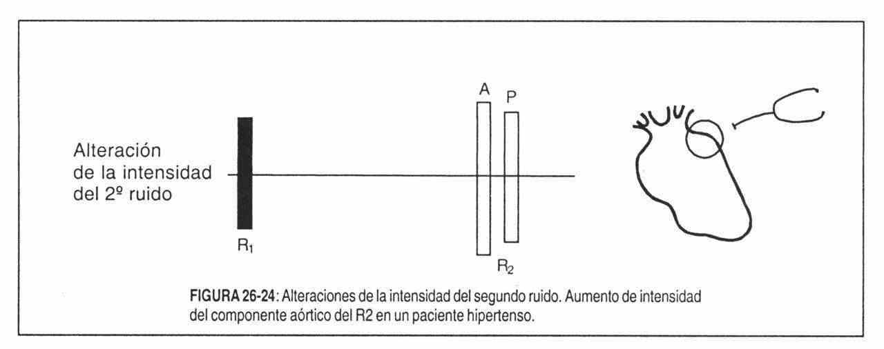 hacardio25