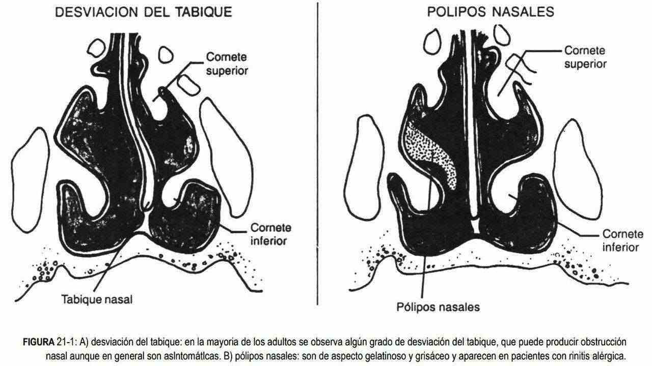 hasenos01