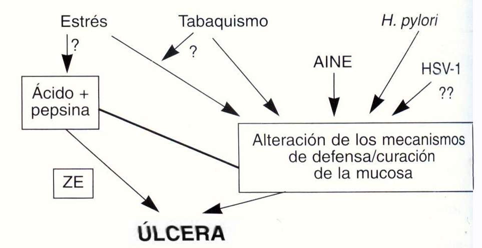 ulcera03