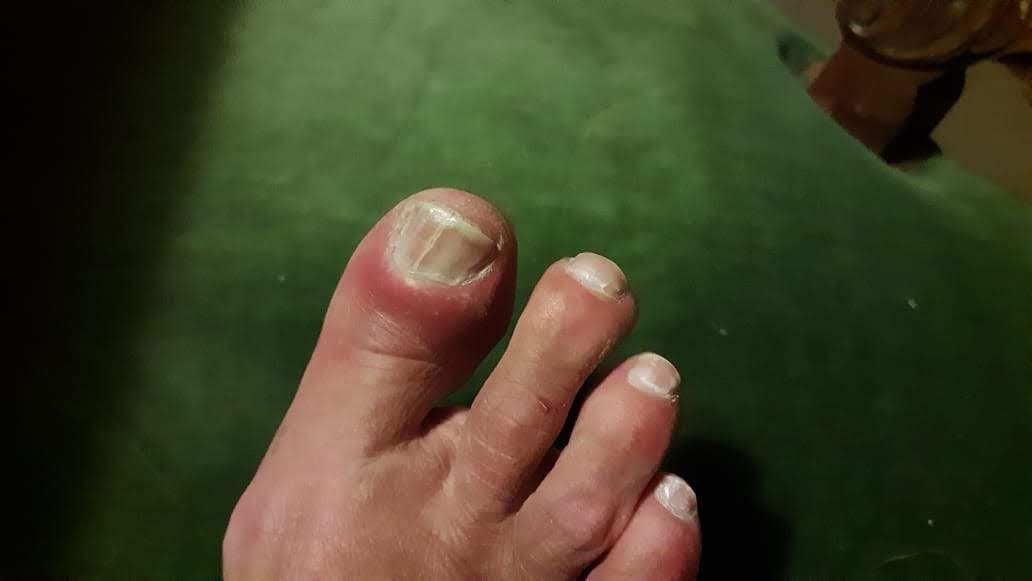 Uñas