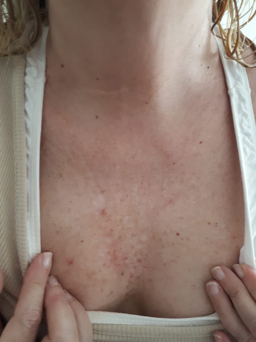 reaccioncoronavirus5