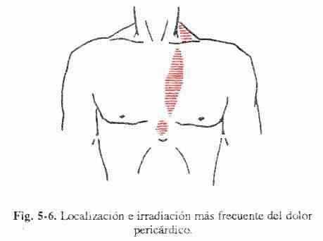 dolor06