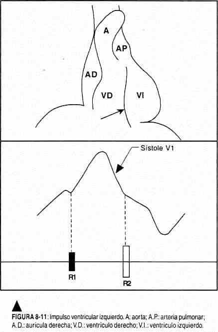 excardio11