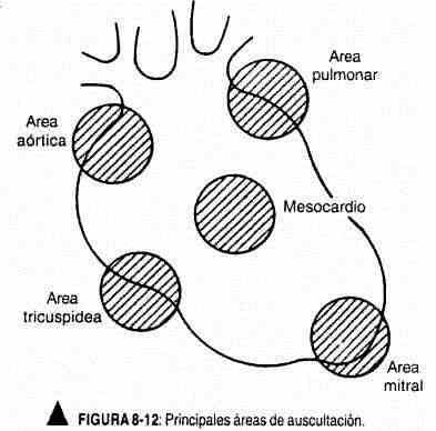 excardio12