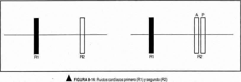 excardio16